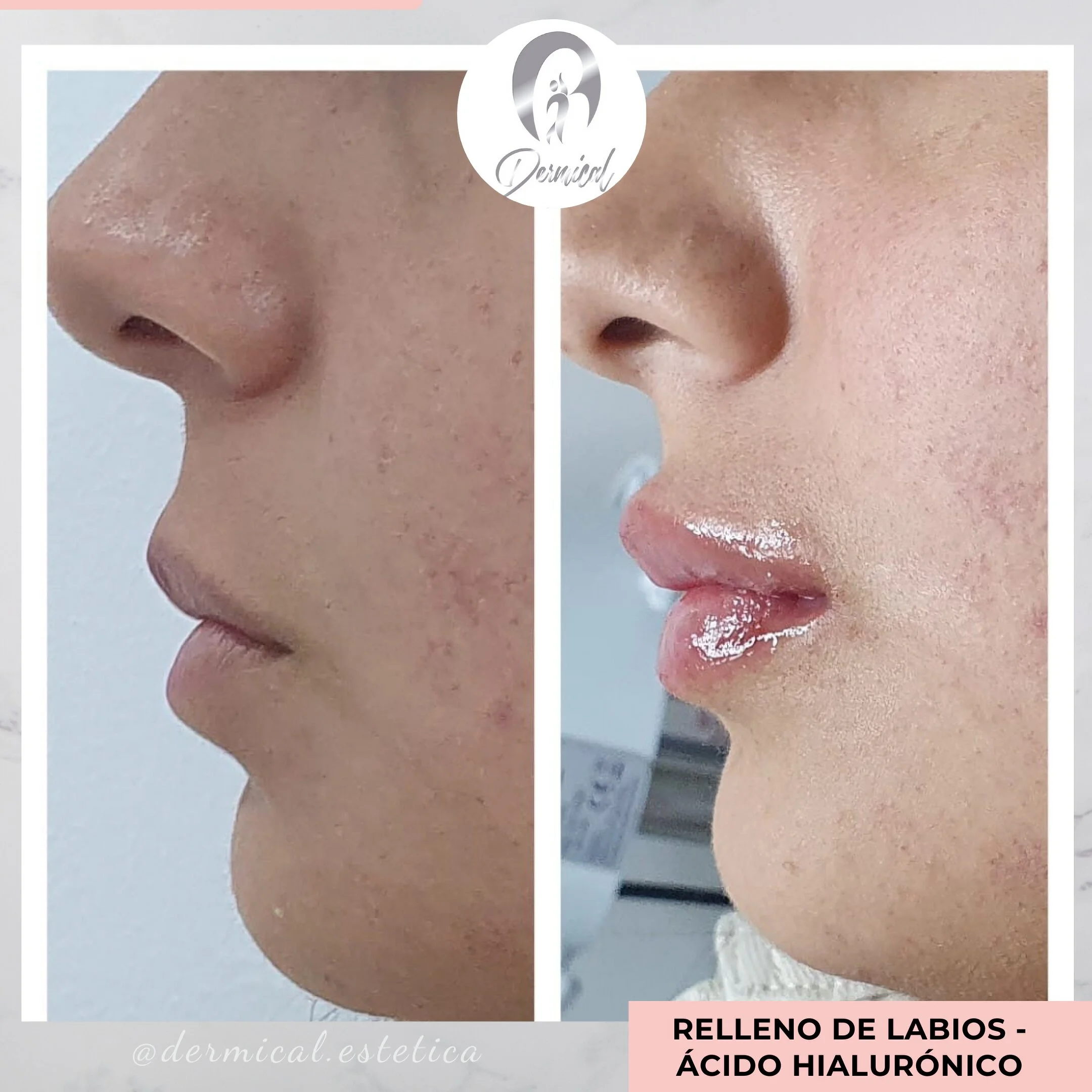 Centro Estético-dermical-estetica-y-laser-edif-ardres-plaza-11665